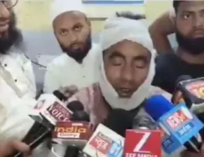 उत्तर प्रदेशातील अलिगढ़मध्ये 'जय श्री राम'चा नारा लावण्यास नकार दिल्याने मशिदीच्या इमामवर अमानुष हल्ला